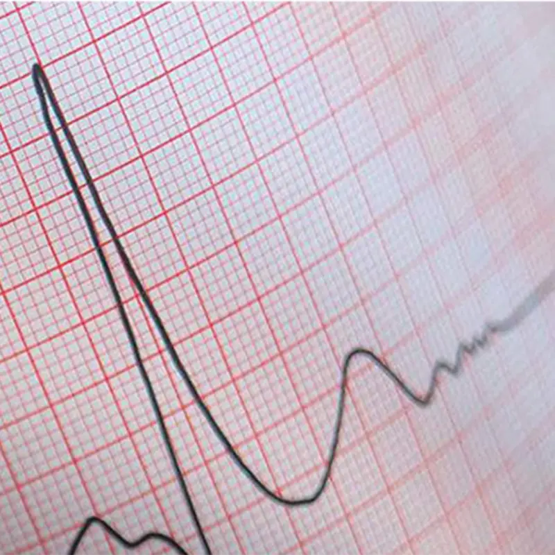 Custom-ECG Paper 48mm 80mm 90mm Hospital ECG Roll Thermal Paper (2).png